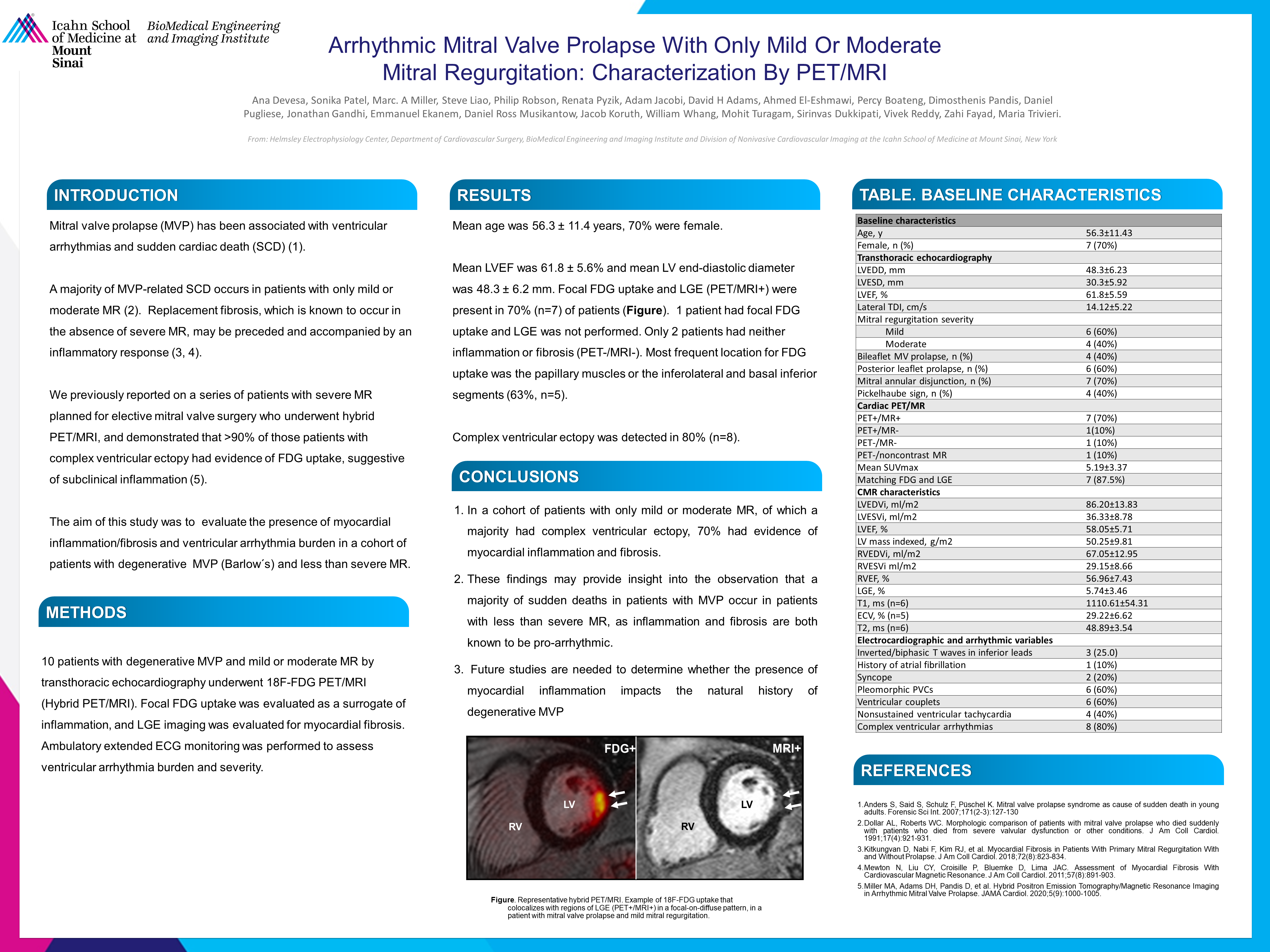 Poster Ana Devesa 2 - BioMedical Engineering And Imaging Institute